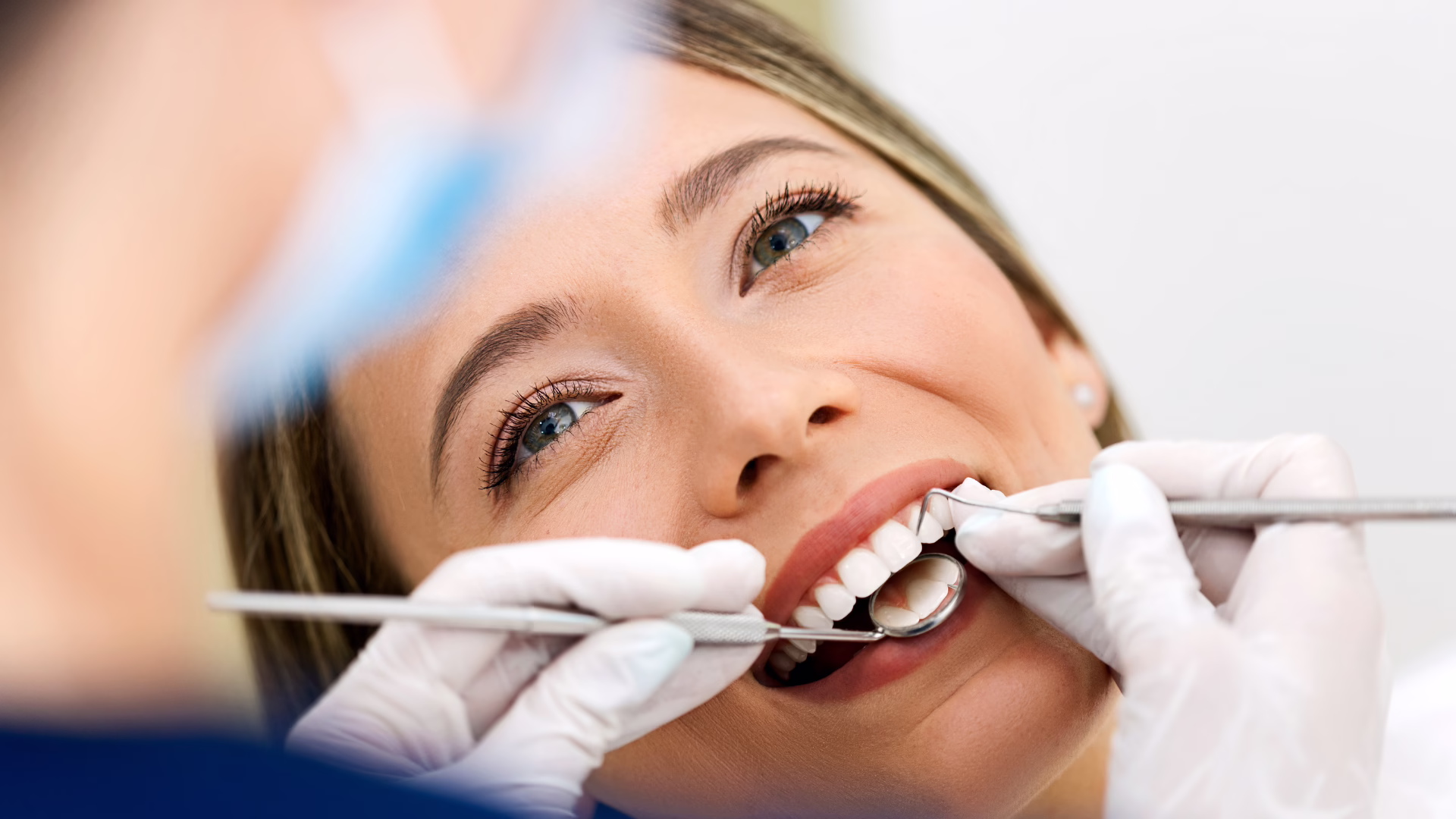 $200 New Patient Exam & X-Rays